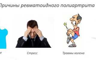 Серонегативный ревматоидный полиартрит