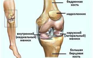 Менисцит коленного сустава что это такое