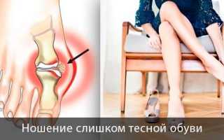 Боль в большом пальце на ноге