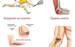 Боль в правом локте