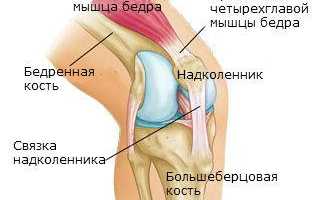 Связки коленного сустава лечение