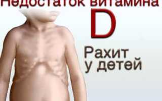 Рахит у детей симптомы и лечение
