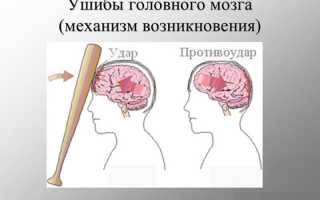 Симптомы и лечение при ушибе головного мозга