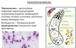 Варианты лечения токсоплазмоза