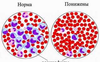 Понижены эозинофилы у ребенка, что это значит?