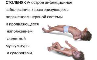 Столбняк — симптомы, признаки и лечение; прививка
