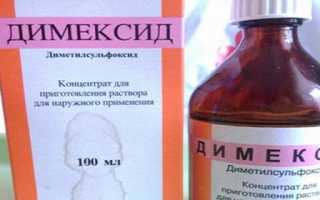Компрессы с димексидом при артрозе