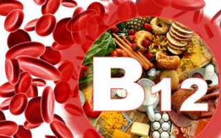 B12 дефицитная анемия