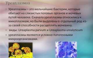 Схема лечения медикаментозными препаратами женского уреаплазмоза