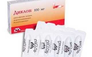 Что такое тендинит