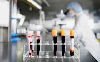 Опасные последствия низкого гемоглобина