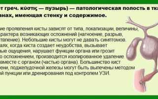 Диагностика и лечение кисты сосудистого сплетения головного мозга у грудничков