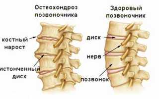 Причины болей затылка с левой стороны головы