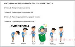 Принципы лечения бронхиальной астмы по протоколу и новые методики терапии