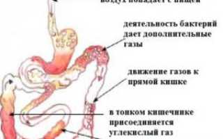 Причины метеоризма: что делать при вздутии живота