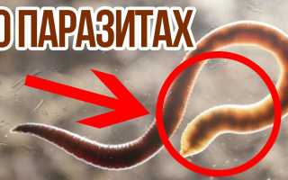 Способы выведения остриц у ребенка самостоятельно
