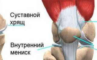 Реабилитация после операции на мениске коленного сустава