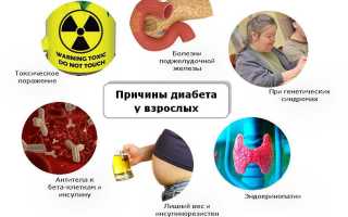 Признаки сахарного диабета у мужчин, профилактика и лечение болезни