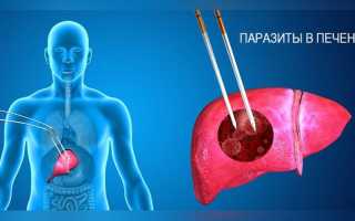 Симптоматика и признаки заражения паразитов в печени человека