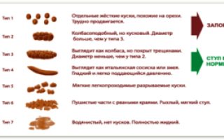лентовидный стул