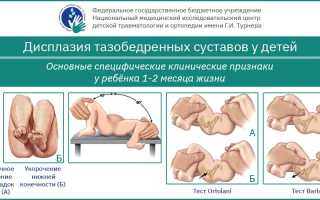 Дисплазия тазобедренного сустава у ребенка