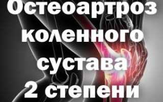 Остеоартроз 2 степени