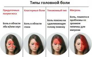 Основные причины боли в левом виске