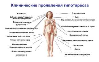 Гипотиреоз — симптомы, лечение, причины, диагностика и профилактика