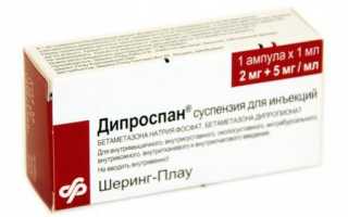 Препараты для блокады суставов