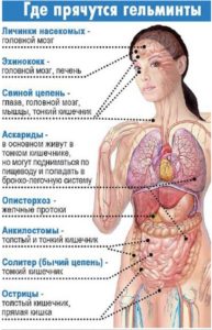 Где прячутся гельминты