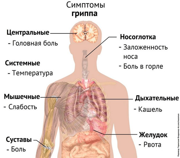 Симптомы гриппа