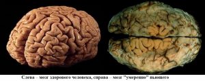 влияние алкоголя на мозг