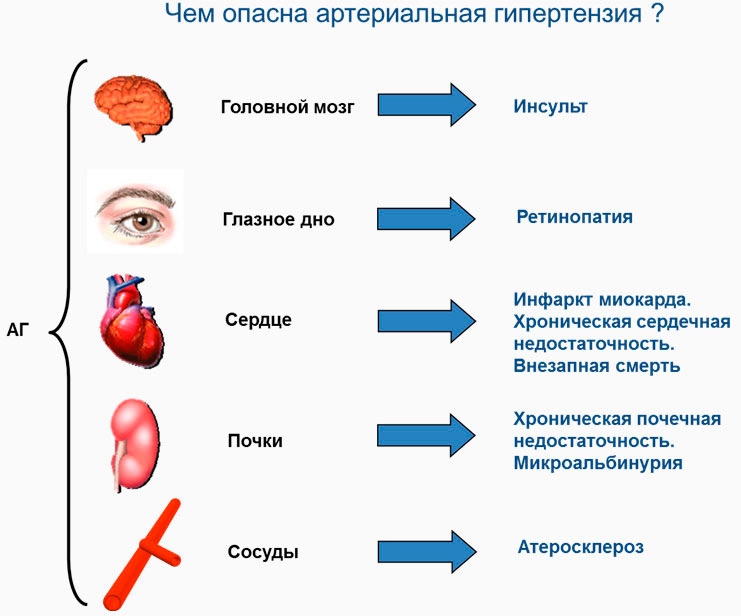 Лечения артериальной гипертензии