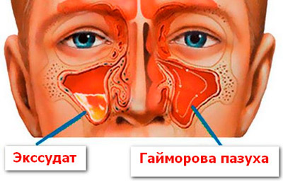 Эссаудит