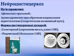 Нейроцистицеркоз
