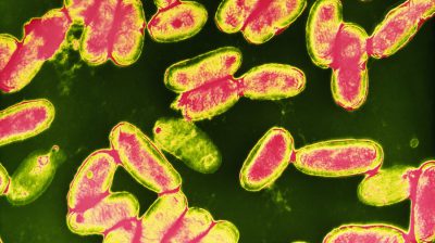 Bordetella pertussis