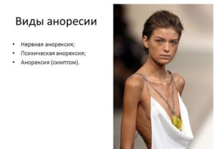 Анорексия