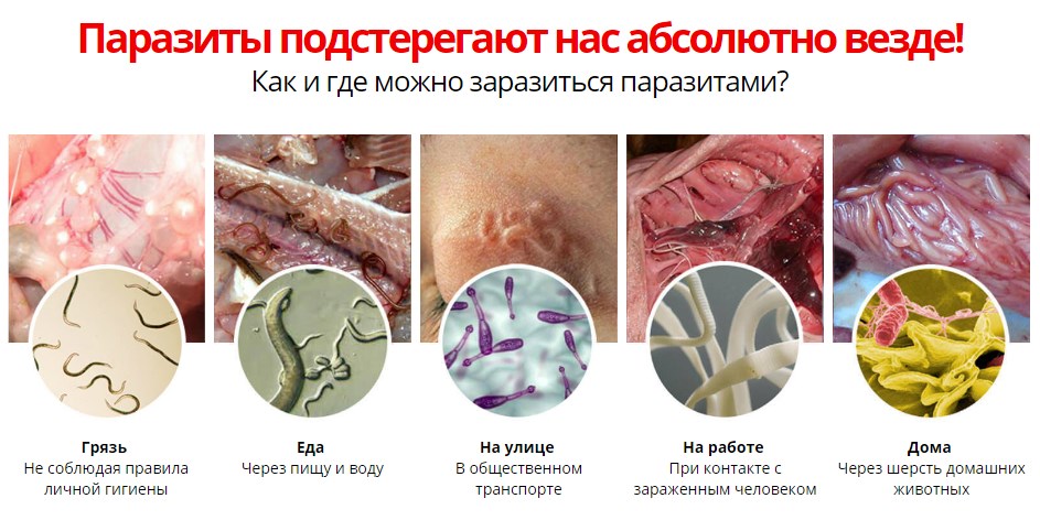Причины возникновения инфекций