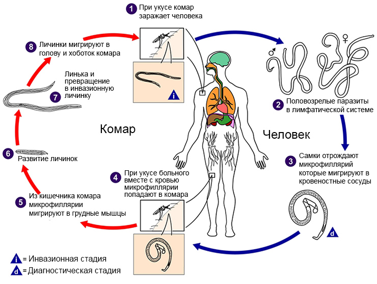 Филярия Банкрофта