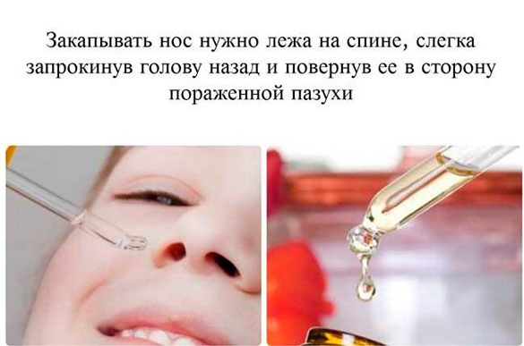 Ка правильно закапывать нос 