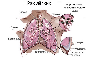 rak