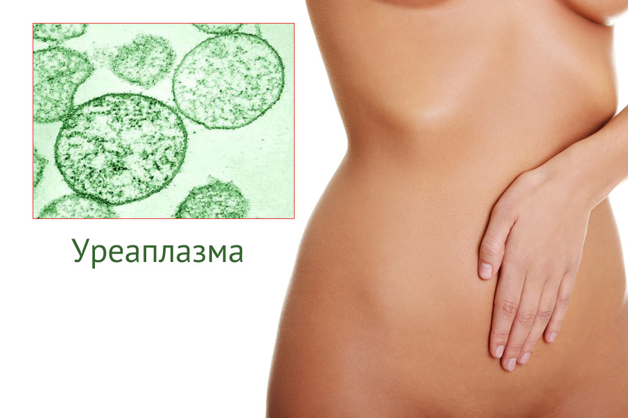 Паразит в организме женщины