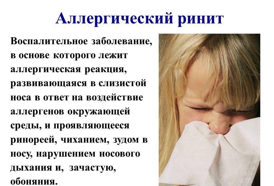 Аллергический ринит
