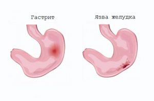 Тан, как эффективное средство от похмелья