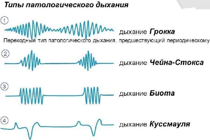 Типы дыхание