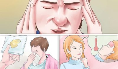 Симптомы синусита
