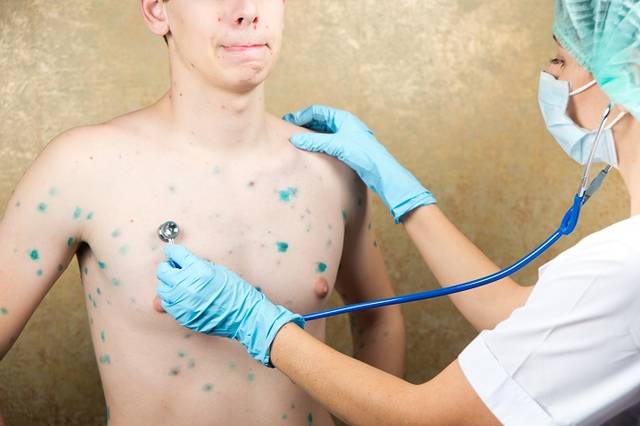 Ветрянка у подростков