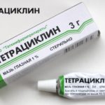 Из-за чего хламидиоз может поразить глаза
