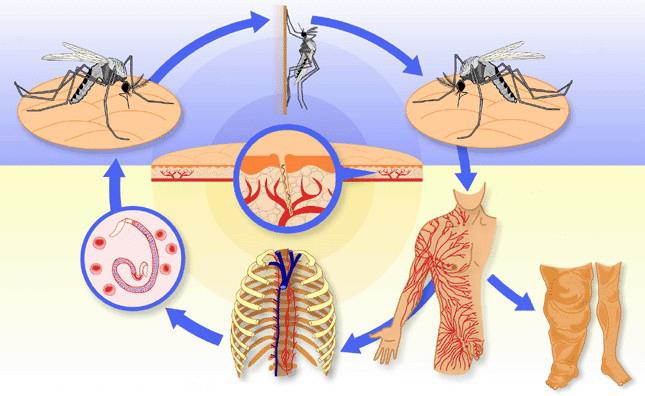 Развития вухерериоза