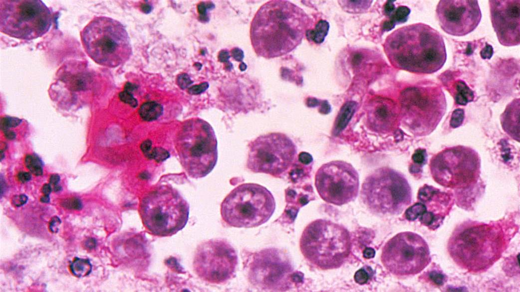 Неглерия фоулера